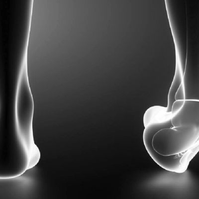 Fracturas y luxaciones
